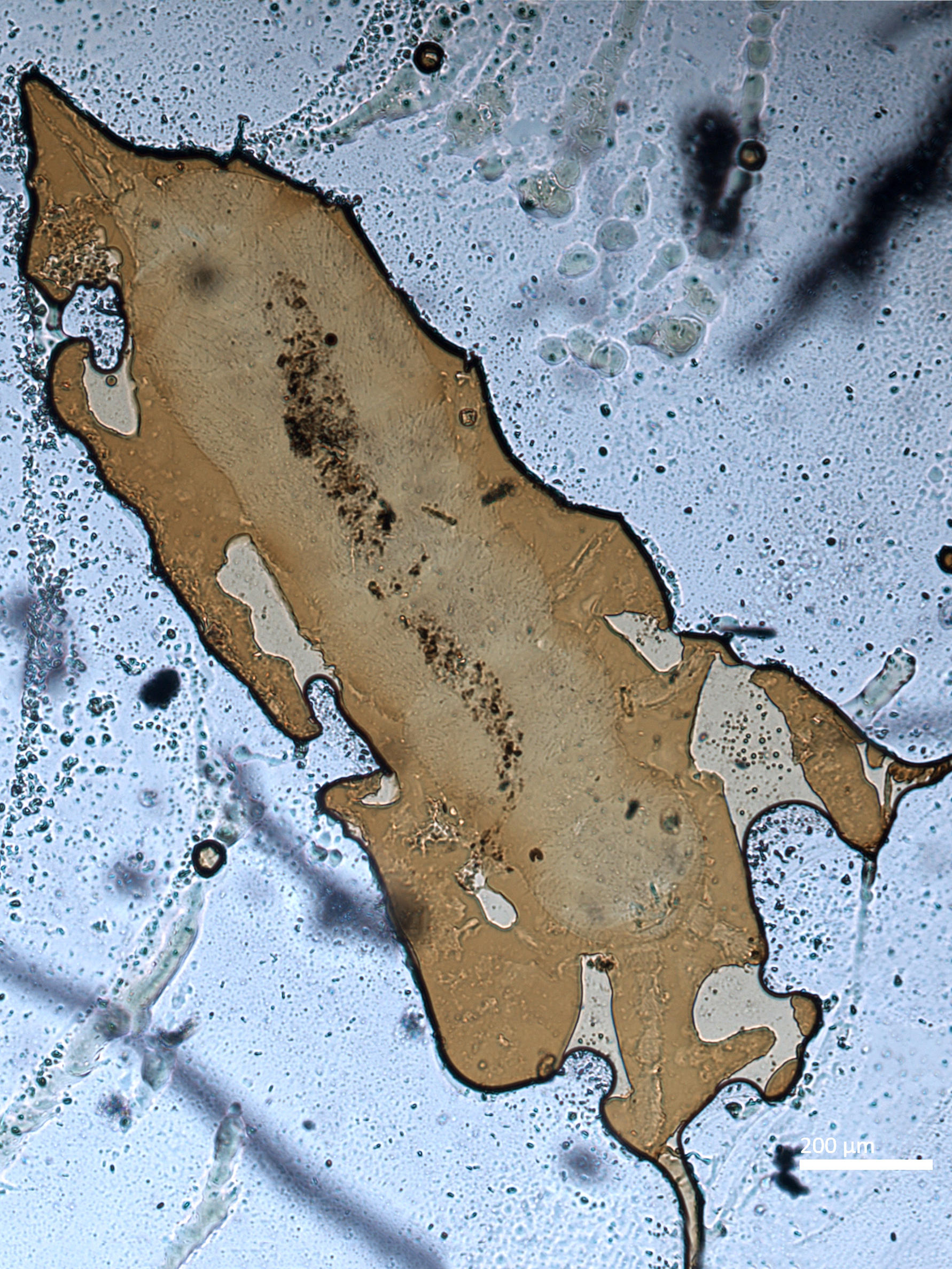 Slide preparation of Hemisotoma thermophila, housed in the ICCDRS collection (ICCDRS 26837). Photo: Marc Barreda, CDF, 2024.
